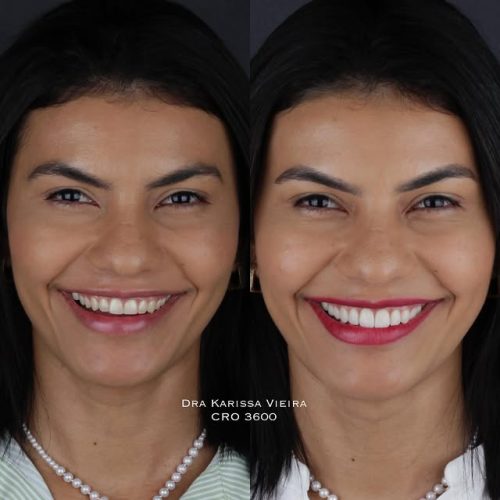 dra.karissavieira_575697804_18324825466244562_9064011900085864583_n